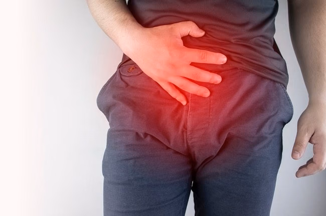 Gejala Hernia